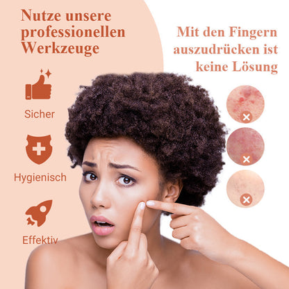 ⚡ ¡50 % DE DESCUENTO! ✨ EXTRACTOR DE PUNTAS NEGRAS DE ACERO INOXIDABLE: juego de 7 piezas para limpieza profunda, herramientas de precisión para el cuidado facial, esterilizables y respetuosas con la piel 🌟🧴