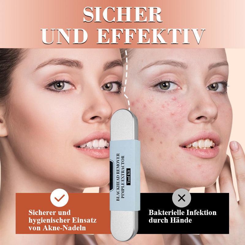 ⚡ ¡50 % DE DESCUENTO! ✨ EXTRACTOR DE PUNTAS NEGRAS DE ACERO INOXIDABLE: juego de 7 piezas para limpieza profunda, herramientas de precisión para el cuidado facial, esterilizables y respetuosas con la piel 🌟🧴
