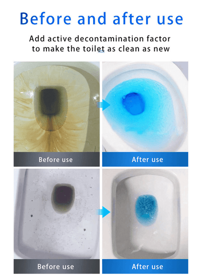 🚿 Desatascador potente, destapa al instante, limpieza total de desagües de cocina! 💪