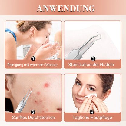 ⚡ ¡50 % DE DESCUENTO! ✨ EXTRACTOR DE PUNTAS NEGRAS DE ACERO INOXIDABLE: juego de 7 piezas para limpieza profunda, herramientas de precisión para el cuidado facial, esterilizables y respetuosas con la piel 🌟🧴