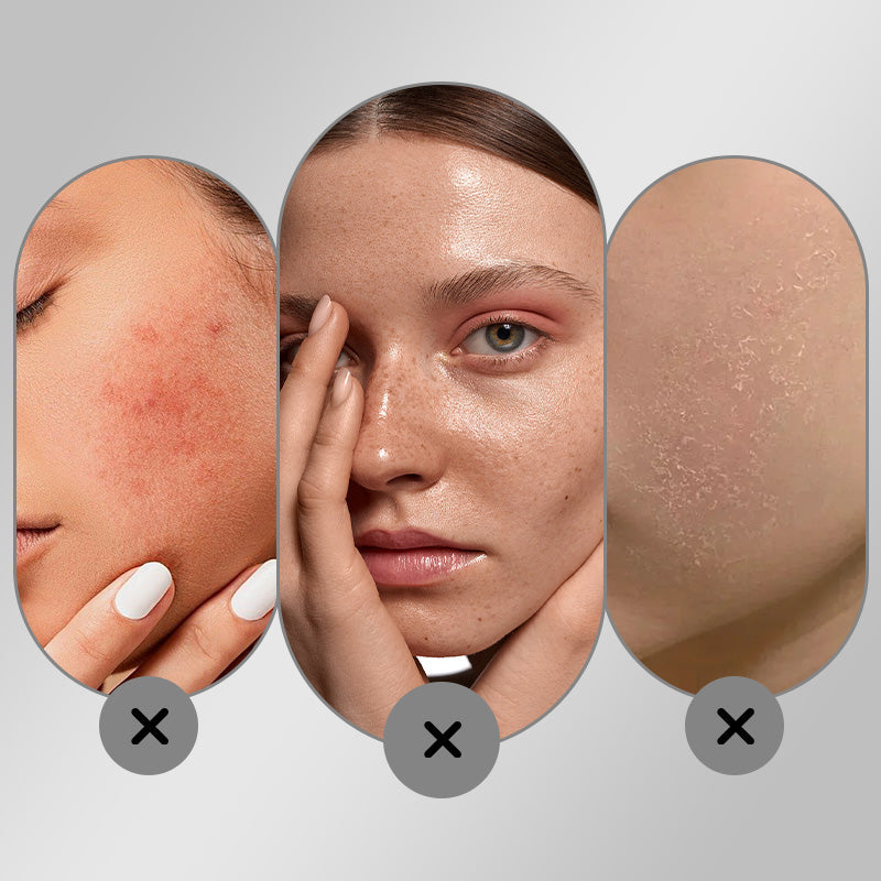 Crema Facial Blanqueadora Hidratante y Despigmentante