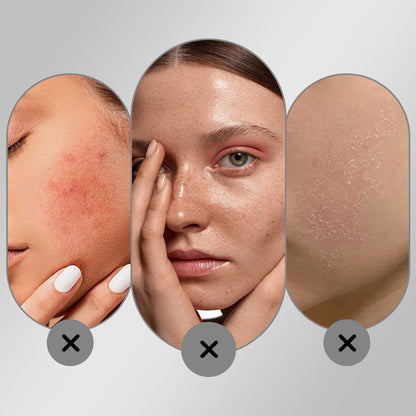 Crema Facial Blanqueadora Hidratante y Despigmentante
