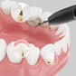 Limpiador dental ultrasónico visible inalámbrico