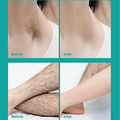 🔥Crema depilatoria corporal sin dolor para hombres y mujeres- Agradable para la piel de todas las zonas🌿