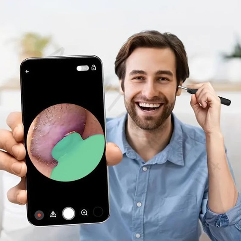 Herramienta de Eliminación de Cerumen con Cámara y Luz