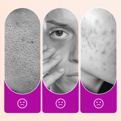 🔥 Corrector de ojeras Flawless｜Brighten Dark Circles, Crease - Free Finish