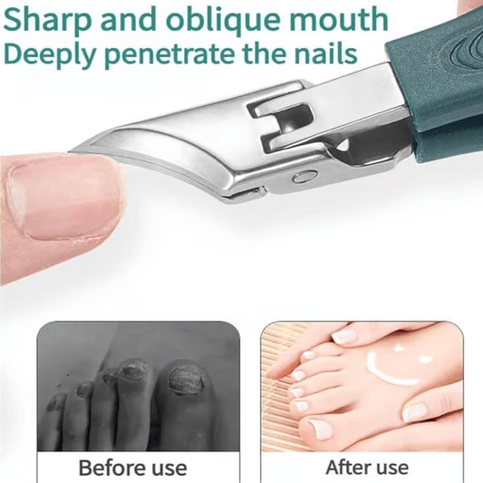 🔥Podiatrist-Recomendado cortaúñas - Diseño ergonómico en ángulo para uñas de los pies y encarnadas - Oferta limitada 49