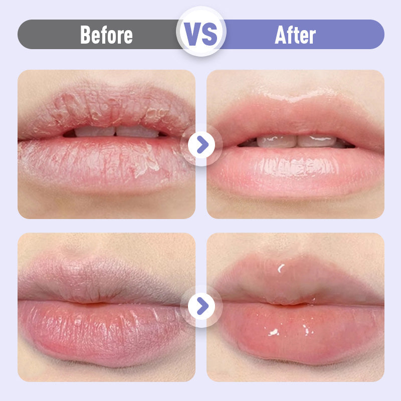 💋 ¡COMPRA 2 LLEVA 3! ✨ Sérum Hidratante Labios - Reduce Arrugas y Repara la Piel Seca en 5 Minutos, Efecto Reafirmante Inmediato 🌸📦