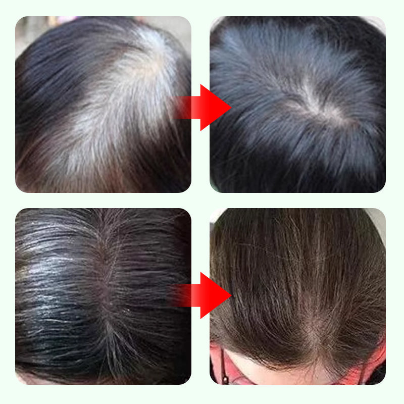 💇‍♀️ ¡Compra 1 y Lleva 1 Gratis! ✨ ¡Rescate de Raíces en 10 Segundos! Lápiz Cubrecanas - ¡Juventud Instantánea en un Click! ✨