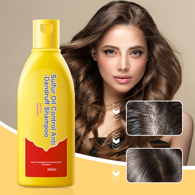 Shampoo de Azufre Control de Grasa y Anticaspa