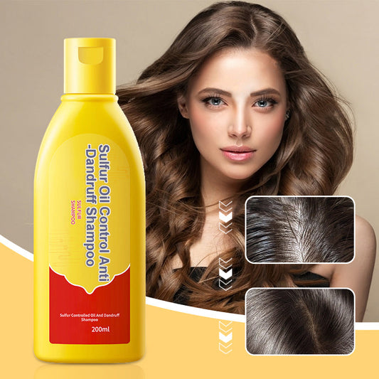 Shampoo de Azufre Control de Grasa y Anticaspa
