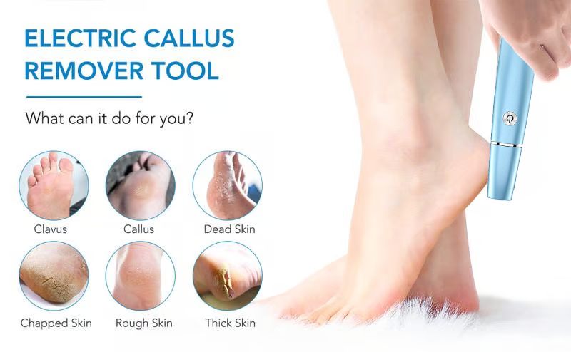 Removedor Eléctrico de Callos para los Pies