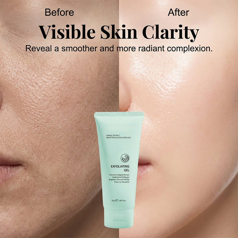 Gel Exfoliante Aclarante con Extractos Herbales para Rostro